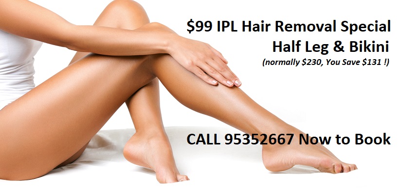 IPL Hair Removal Mandurah